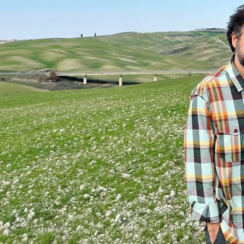 "Η λεύκη που έχω είναι κάτι πολύ φυσιολογικό και δεδομένο"