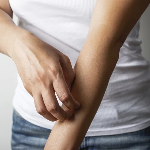 Ιός Δυτικού Νείλου: Τι να προσέχεις σύμφωνα με τον καθηγητή Τζανάκη