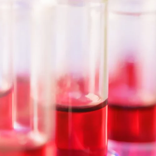 Νέα θεραπεία για το πολλαπλό μυέλωμα