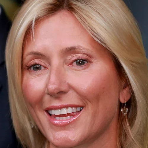 Marie-Chantal: Η τεχνική που ακολουθεί για φυσικό lifting στο πρόσωπο