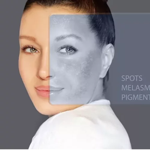 Ποιος φοβάται τις κηλίδες; Όχι εγώ!