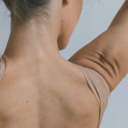 Ραγάδες στους ώμους: Τι τις προκαλεί και πώς να τις αντιμετωπίσεις;