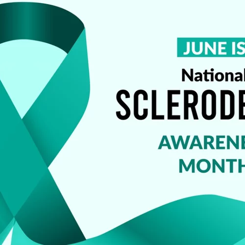 Σκληρόδερμα: Το αυτοάνοσο που "προτιμά" τις γυναίκες