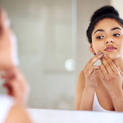 5 απίθανοι λόγοι για τους οποίους εμφανίζεις σπυράκια στο πρόσωπο