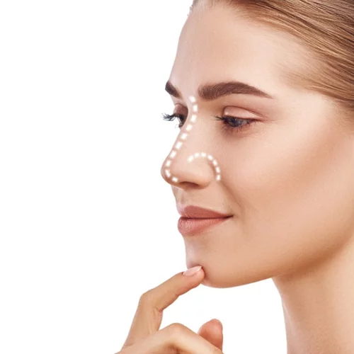 Ρινοπλαστική: Ποιο είναι  το "τέλειο" αποτέλεσμα;