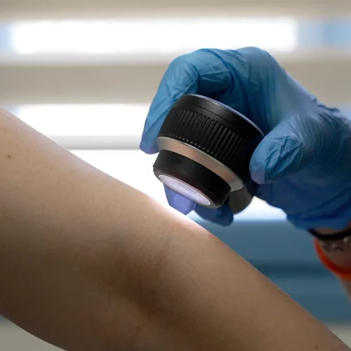 La Rοche-Posay & ΑγκαλιάΖΩ: Δωρεάν έλεγχος σπίλων σε 4 ακριτικά νησιά