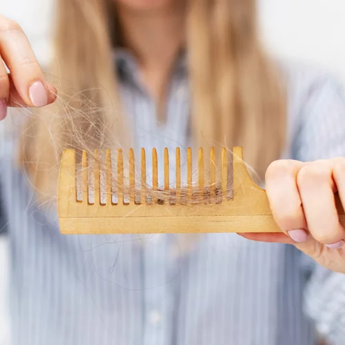 Τριχόπτωση: Είναι η "ζάχαρη" η νέα υποσχόμενη θεραπεία;