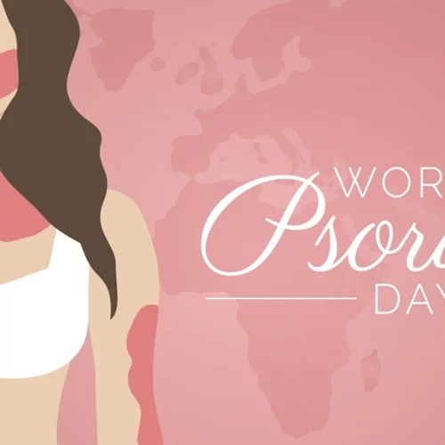 Ψωρίαση: Όλες οι εξελίξεις στη θεραπεία