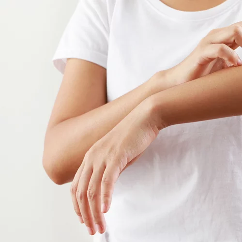 Μην τρως αυτό εάν έχεις έκζεμα, σύμφωνα με μελέτη