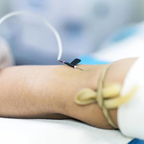 Καρκίνος του παγκρέατος: Πώς μια απλή αιμοληψία μπορεί να δώσει έγκαιρη διάγνωση;