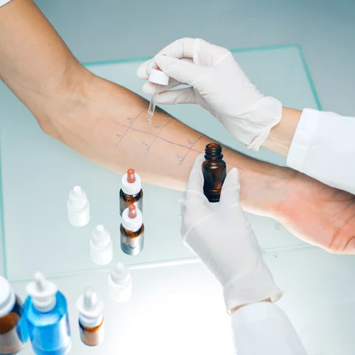 ΙΑΣΩ Γενική Κλινική: Εκμεταλλεύσου τις προνομιακές τιμές και εκπτώσεις για αλλεργιολόγο και διαγνωστικά τεστ