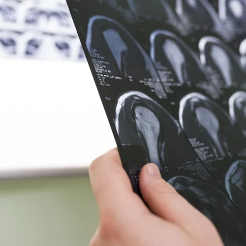 Η σημασία της εξειδίκευσης στην Ορθοπαιδική και το όραμα της Synovus στην Αθήνα