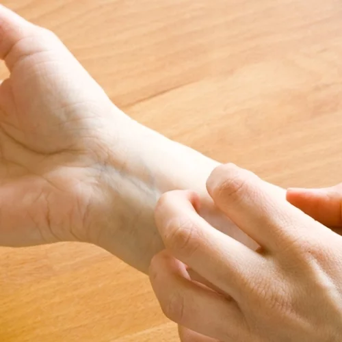 Παγκόσμια Ημέρα Ψωρίασης: Πρόσβαση για όλους