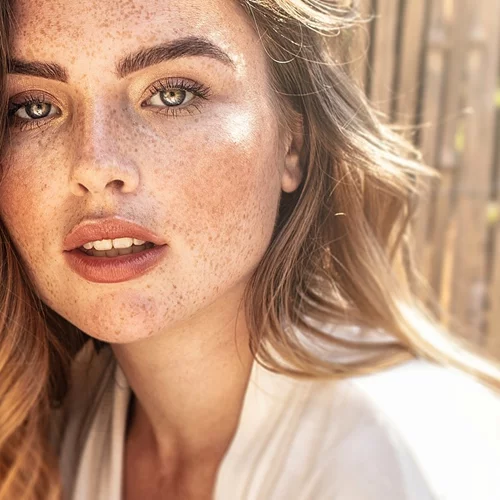 Καφέ κηλίδες: 3 αλλαγές που πρέπει οπωσδήποτε να κάνεις τώρα στη ρουτίνα σου