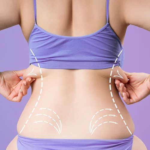 Λιποκύτταρα: Οι επιστήμονες βρήκαν πώς θα τα συρικνώσουν!