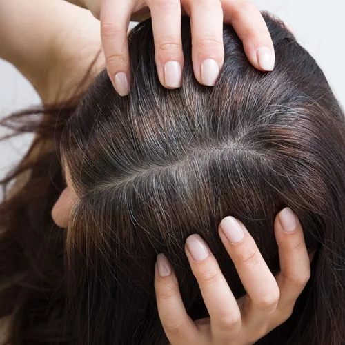 Επιστήμονες ανακαλύπτουν φυσική θεραπεία για τα γκρίζα μαλλιά – Το συστατικό που αποτρέπει το γκριζάρισμα + σε ποιες τροφές θα το βρεις!