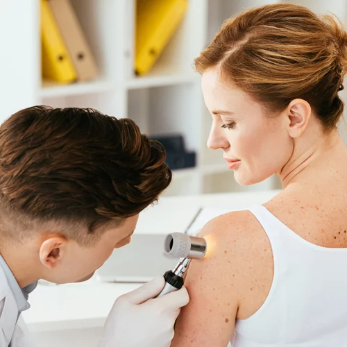 Ελέγξτε τους σπίλους στο δέρμα σας προτού βγείτε στον ήλιο