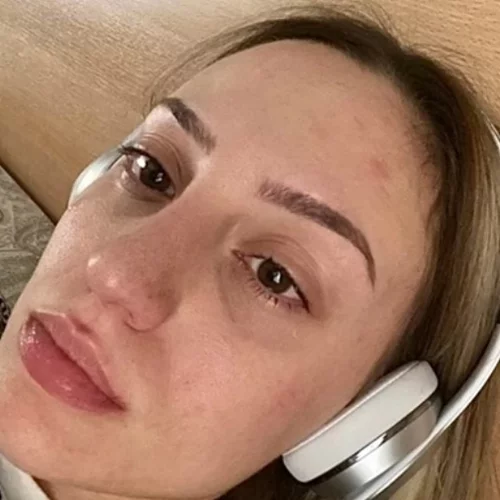 Άννα Κορακάκη: "Υποφέρω από αϋπνίες, ανασφάλεια και καταθλιπτικά επεισόδια"