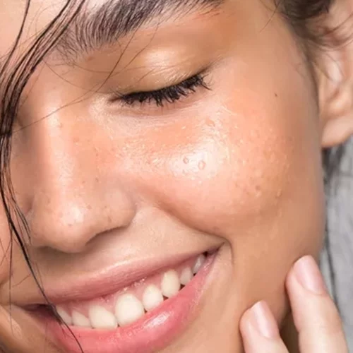 Το προϊόν που κάνει τα μαύρα στίγματα σε μύτη-μέτωπο-πιγούνι παρελθόν