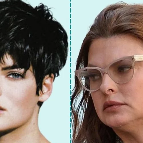 Οι διάσημες κυρίες που παραμορφώθηκαν μετά από πλαστική επέμβαση