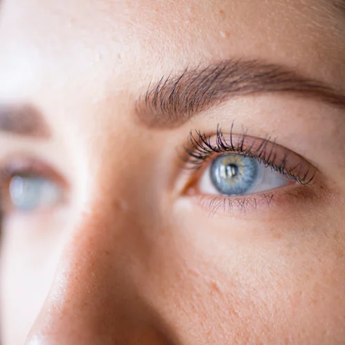 Τρίβεις τα μάτια σου πολύ συχνά και άλλα συμπτώματα που δείχνουν ότι πάσχεις από κερατόκωνο