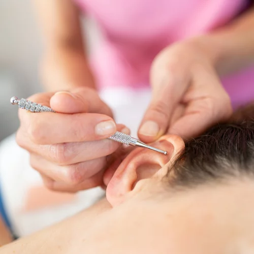 Νέο trend στο TikTok: Τι είναι το "ear seeding" και μπορεί πραγματικά να σε βοηθήσει;