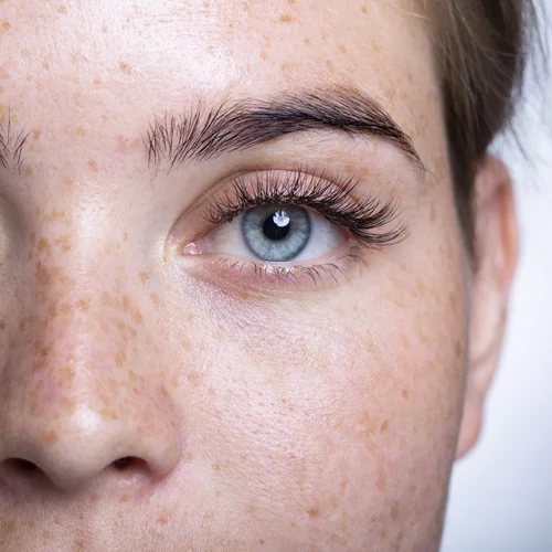 Μαύροι κύκλοι: Η συχνή αιτία που τους προκαλεί και ο εύκολος τρόπος για να τους "εξαφανίσουμε"