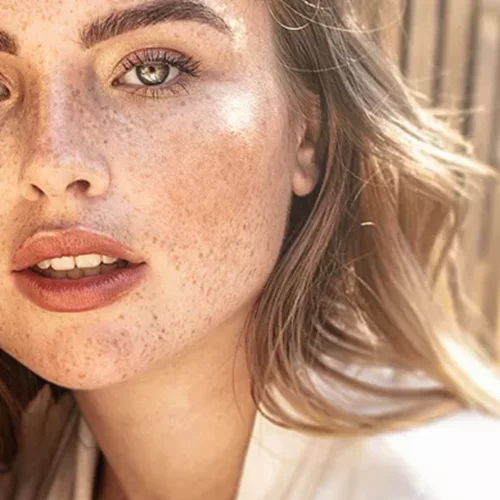 Τα καλύτερα έλαια προσώπου για λιπαρές επιδερμίδες