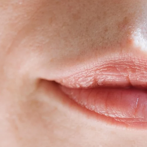 Ρυτίδες γέλιου: Το makeup hack για να τις εξαφανίσεις φυσικά