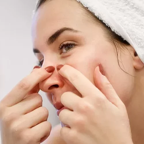 Πώς φεύγουν τα εσωτερικά σπυράκια; Τα do's και don'ts