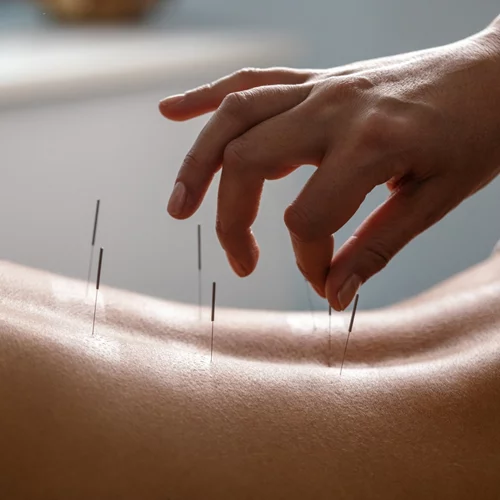 Μάθε τα οφέλη της χρήσης του βελονισμού στο 11ο Διεπιστημονικό Συμπόσιο Βελονισμού