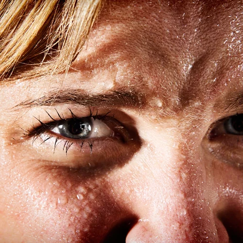 Τι είναι ο κρύος ιδρώτας που σε "λούζει" ξαφνικά και πώς διαφέρει από τον ζεστό;