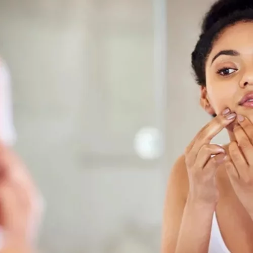 Το εγγυημένο hack μακιγιάζ που θα "σβήσει" στη στιγμή τα σπυράκια