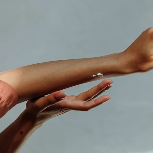 Καφέ κηλίδες στα χέρια: Οι 3 πιο αποτελεσματικοί τρόποι να τις μειώσεις