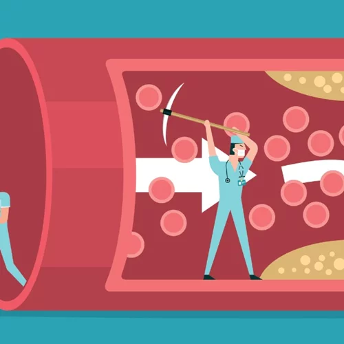 Οικογενής υπερχοληστερολαιμία: Τι είναι, τα συμπτώματα, η διάγνωση και η θεραπεία