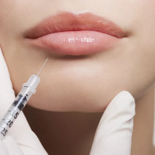 Botox από μη ειδικούς | Ποιους κίνδυνους ενέχει και τι πρέπει να προσέχεις
