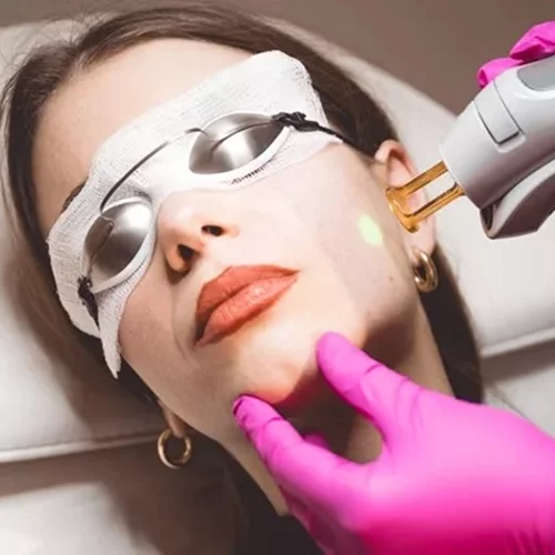 Cherry Laser & Beauty: Το νέο κέντρο αισθητικής που έχει γίνει ήδη ο παράδεισος των beauty lovers