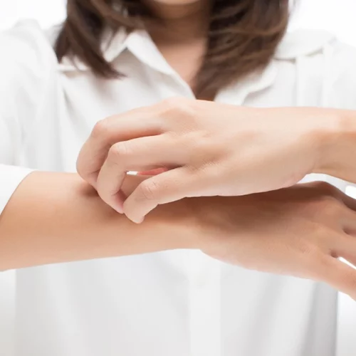 Οι celebrities που πάσχουν από ψωρίαση και όσα πρέπει να γνωρίζεις για τη νόσο