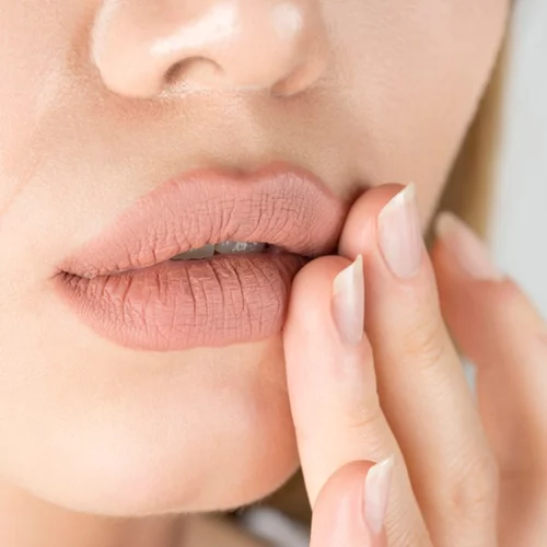 Έρπης στα χείλια: Τι να προσέχεις και πώς δε θα ξαναεμφανιστεί ο επιχείλιος έρπης