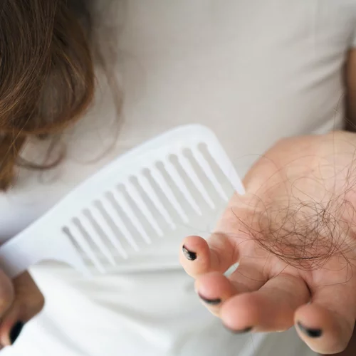 Τριχόπτωση; Αραίωση; Απώλεια όγκου; Έτσι θα αποκτήσεις νεανικά και υγιή μαλλιά μετά τα 50