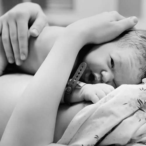 Καισαρική τομή: Σε ποιες περιπτώσεις είναι απαραίτητη;