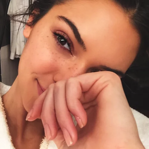 Γιατί ΔΕΝ θα δοκιμάσουμε τη σπιτική μάσκα κατά της ακμής από την Kendall Jenner