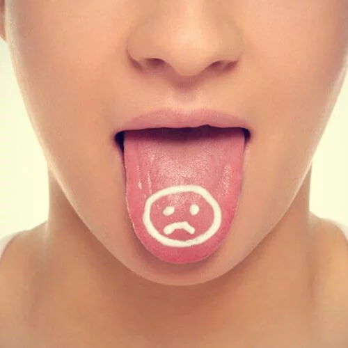 Να γιατί πρέπει να προσέχεις τα δόντια και το στόμα σου