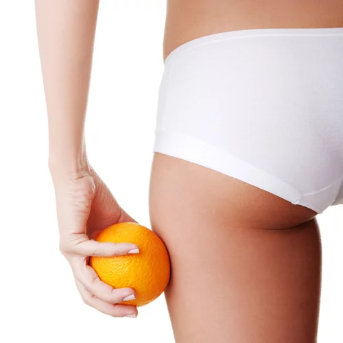 Βρήκαμε τον τρόπο να αντιμετωπίσεις την αιτία της κυτταρίτιδας! (όχι τα συμπτώματα!)