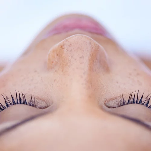 Μαύρα στίγματα στη μύτη; Δες πώς θα τα ξεφορτωθείς