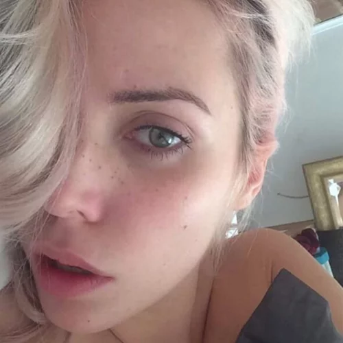 Nα γιατί τώρα όλες κάνουν τατουάζ... φακίδες!