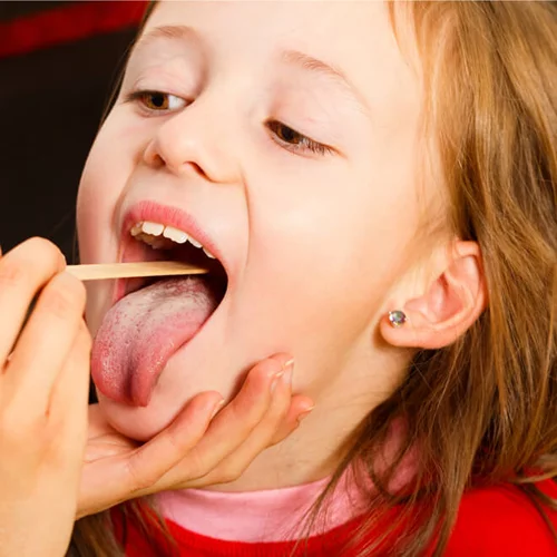 Οξεία λαρυγγίτιδα στο παιδί: Ποια είναι η σωστή αντιμετώπιση;