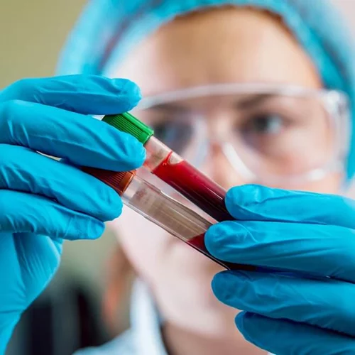 Αναπτύχθηκε νέο τεστ αίματος που ανιχνεύει τον καρκίνο!