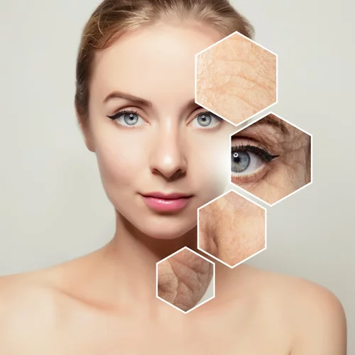 Θέλεις να κάνεις μπότοξ; Δες τι πρέπει να προσέξεις