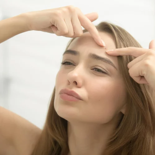 Έρχεται εμβόλιο κατά της ακμής;